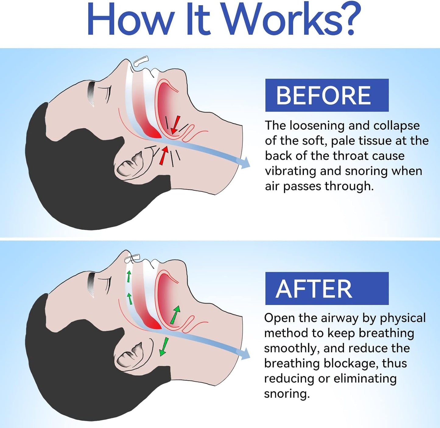 Anti Snoring Nose Clip Device for Men Women